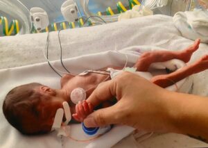 Premature baby holding a hand