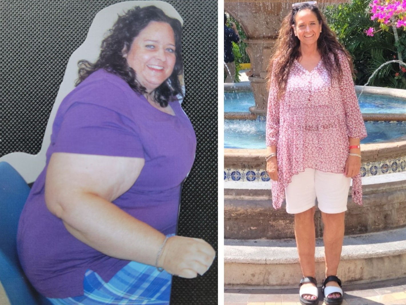 Woman before and after weight loss